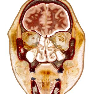 Frontal dargestellter Anatomie-Digitaldruck eines menschlichen Kopfes auf bedrucktem Acrylglas, präzise konturgeschnitten mit der eurolaser XL-Line Laserschneidmaschine