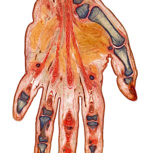 Anatomischer Digitaldruck einer menschlichen Hand auf Acrylglas, präzise konturgeschnitten mit der eurolaser XL-Line Laserschneidmaschine für medizinische Lehrzwecke