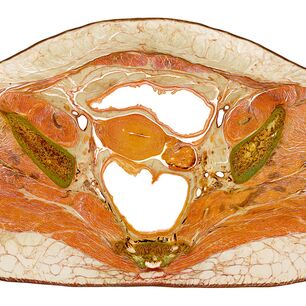 Detailgetreuer Anatomie-Digitaldruck eines Beckens auf Acrylglas, präzise im Konturzuschnitt mit der eurolaser XL-Line Laserschneidmaschine gefertigt